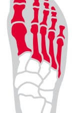 Avant-pied
