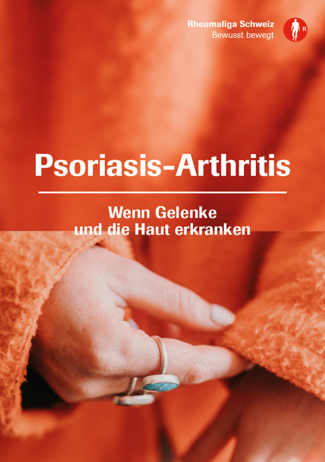 Broschüre Psoriasis-Arthritis